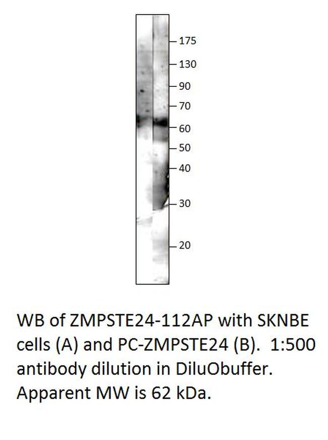 ZMPSTE24 Antibody in Western Blot (WB)