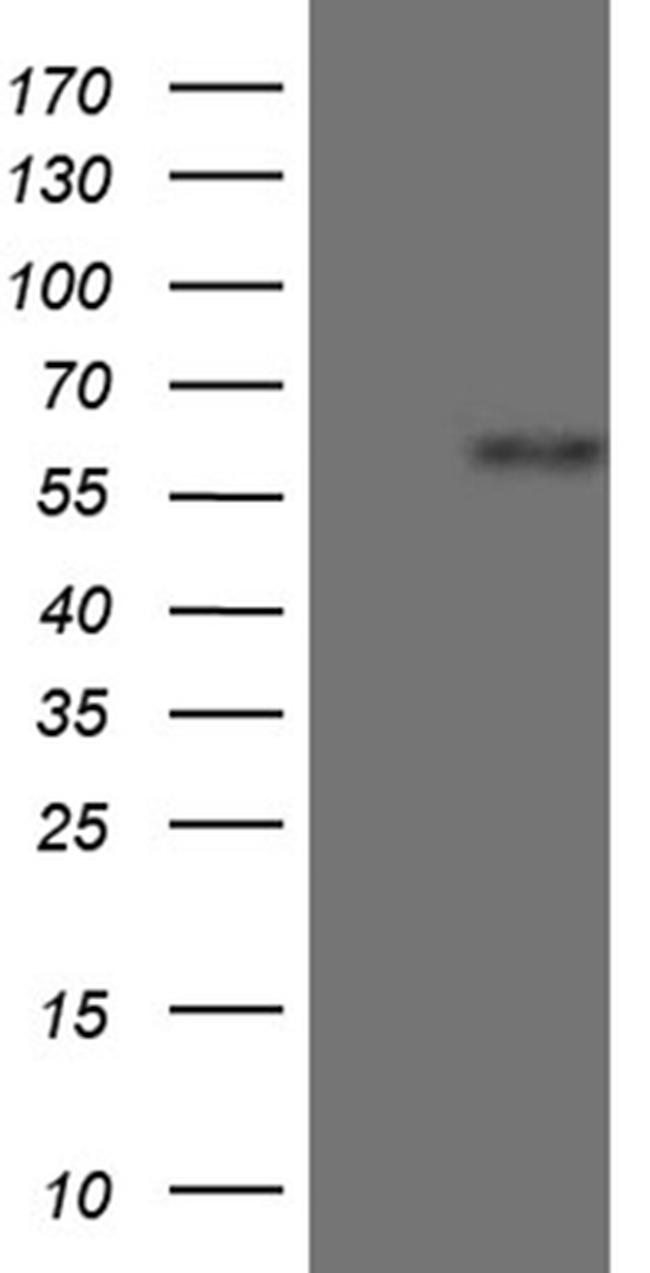 ZNF181 Antibody in Western Blot (WB)