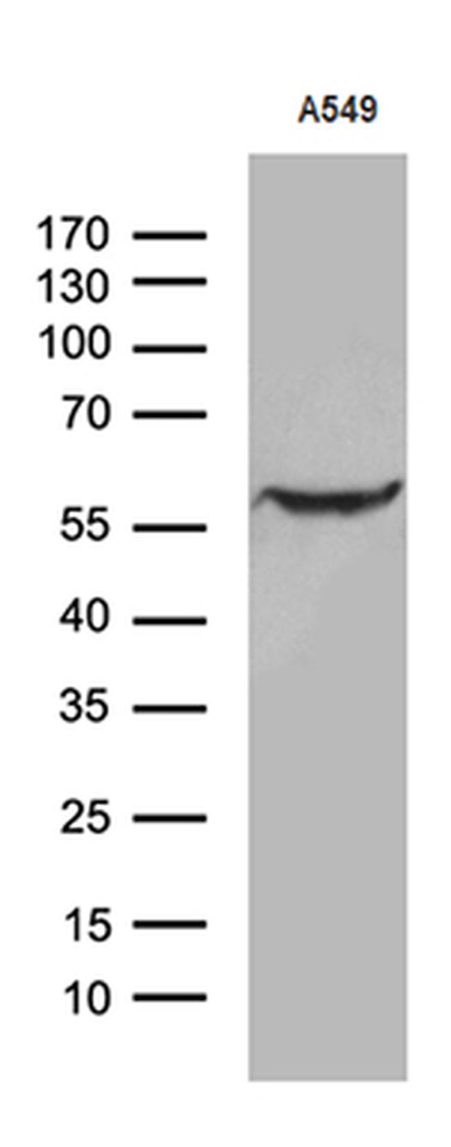 ZNF19 Antibody in Western Blot (WB)