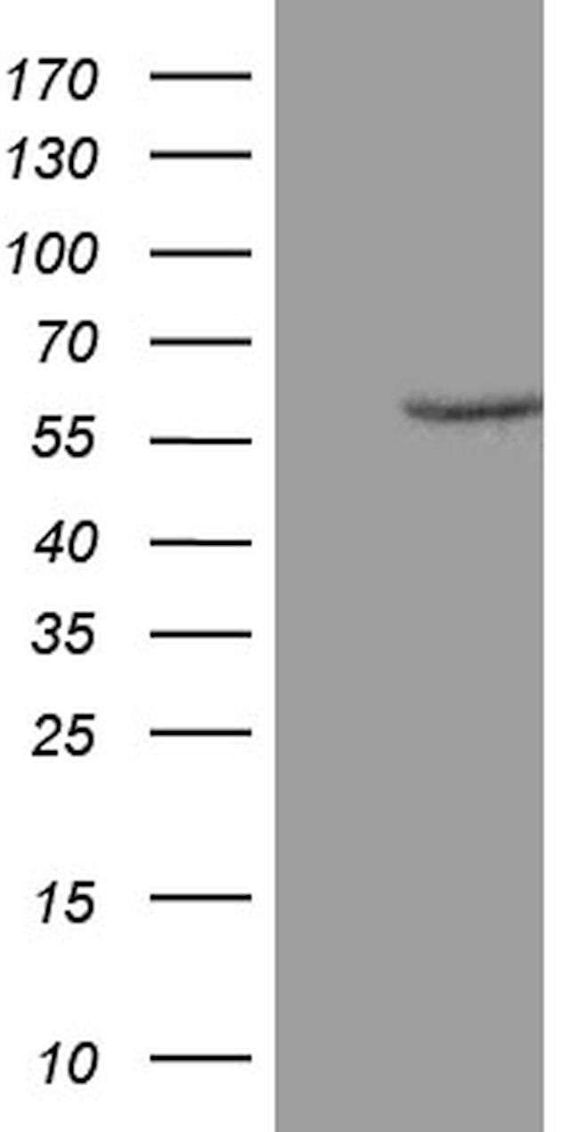 ZNF213 Antibody in Western Blot (WB)