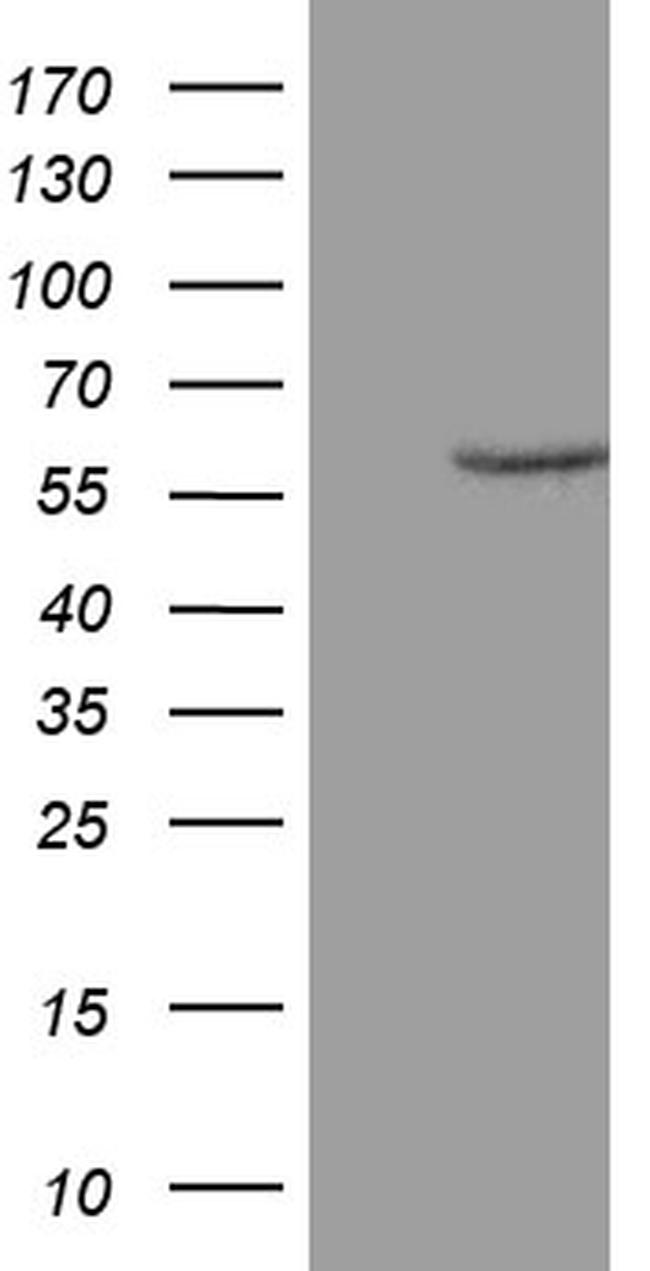ZNF213 Antibody in Western Blot (WB)