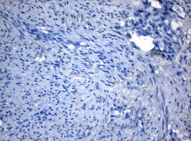 ZNF217 Antibody in Immunohistochemistry (Paraffin) (IHC (P))