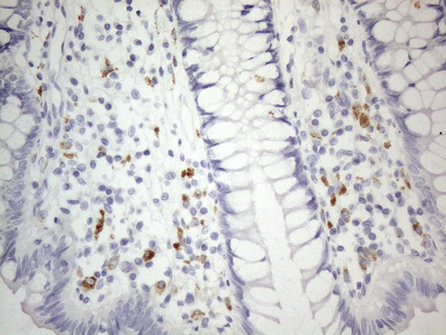 ZNF217 Antibody in Immunohistochemistry (Paraffin) (IHC (P))