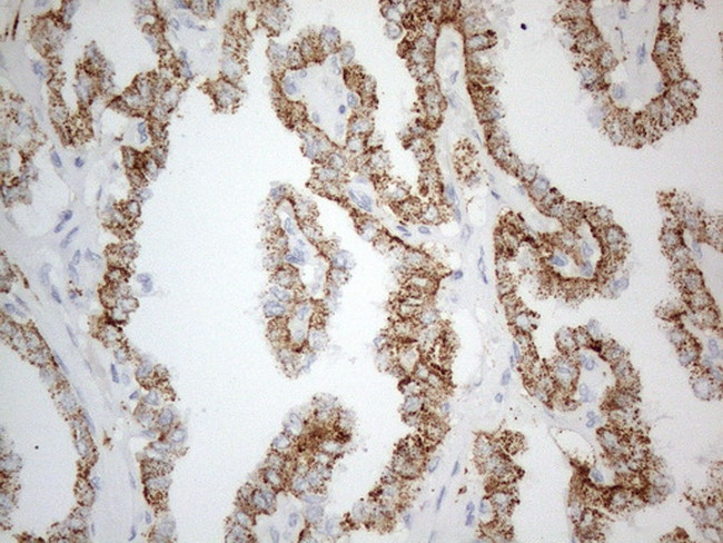 ZNF217 Antibody in Immunohistochemistry (Paraffin) (IHC (P))