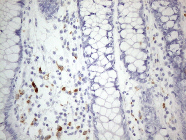 ZNF217 Antibody in Immunohistochemistry (Paraffin) (IHC (P))