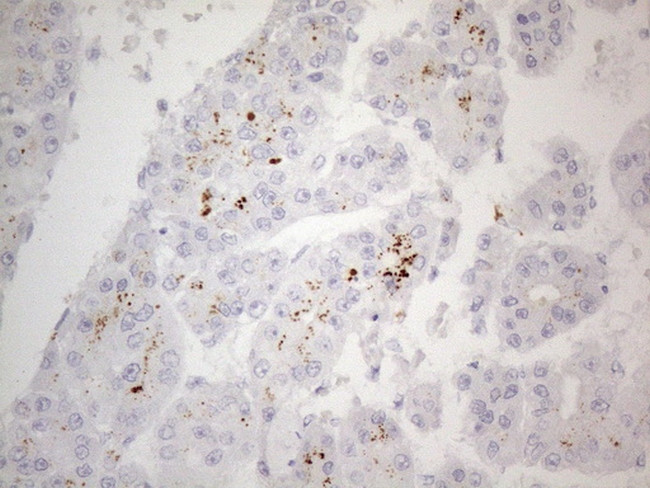 ZNF217 Antibody in Immunohistochemistry (Paraffin) (IHC (P))