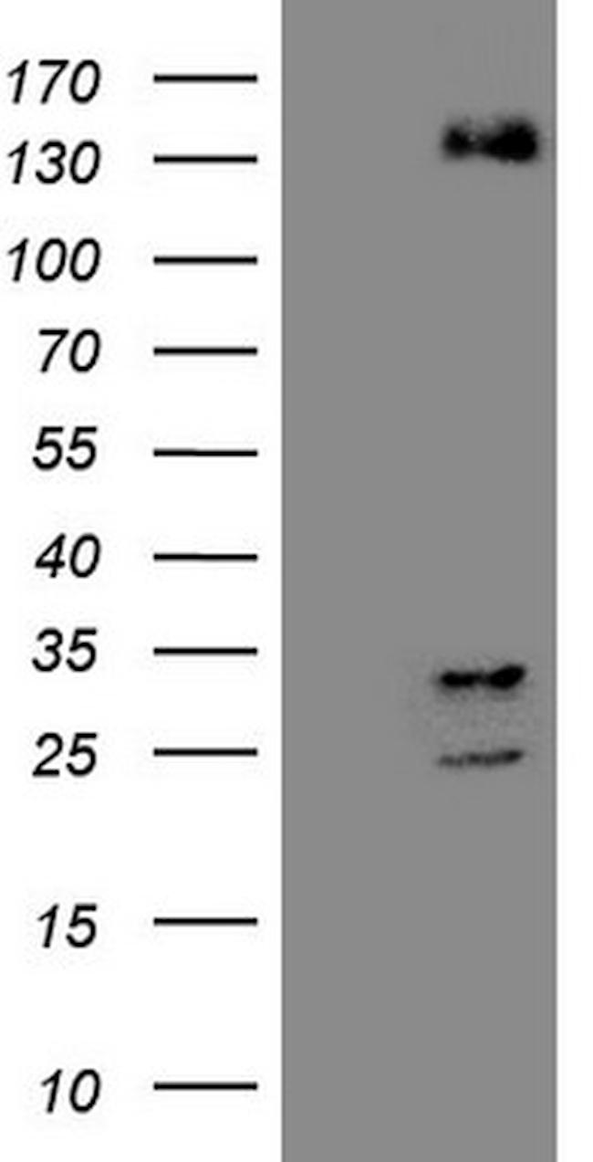 ZNF217 Antibody in Western Blot (WB)