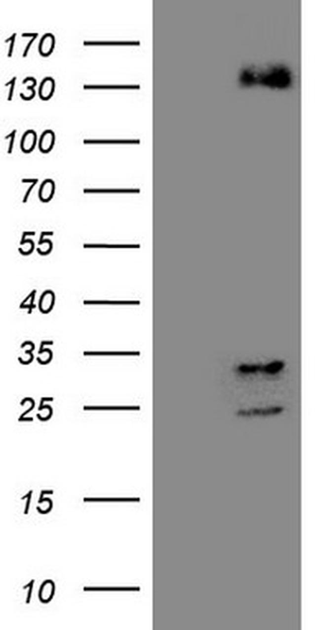 ZNF217 Antibody in Western Blot (WB)
