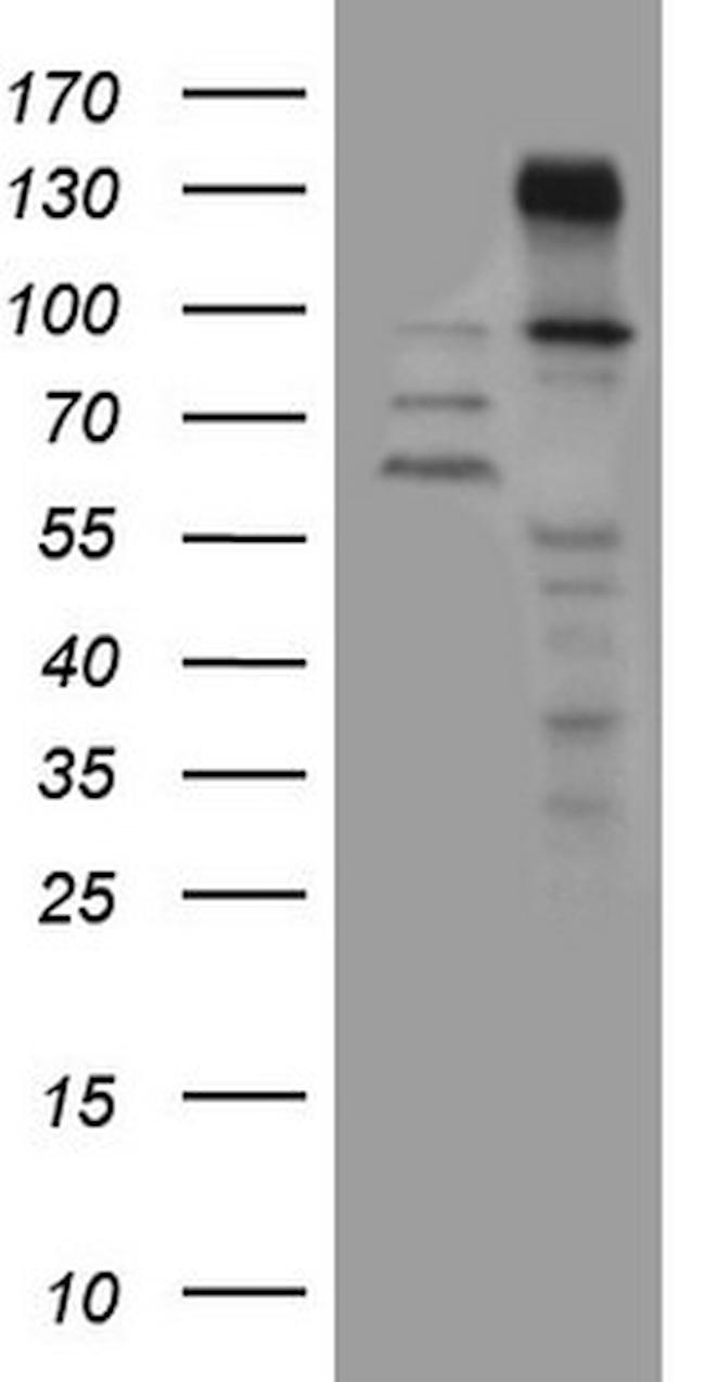 ZNF217 Antibody in Western Blot (WB)