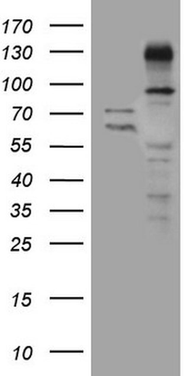 ZNF217 Antibody in Western Blot (WB)