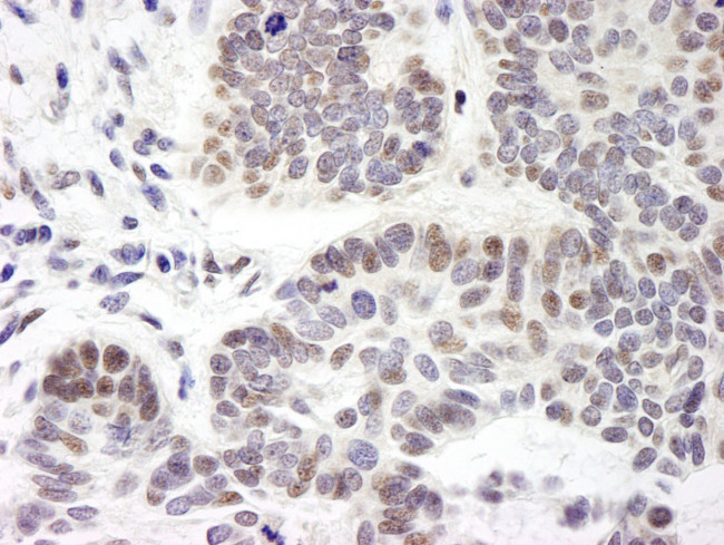 ZNF261 Antibody in Immunohistochemistry (IHC)