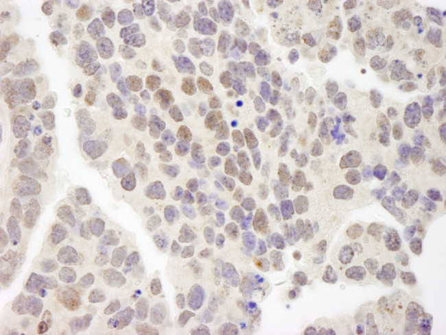 ZNF261 Antibody in Immunohistochemistry (IHC)