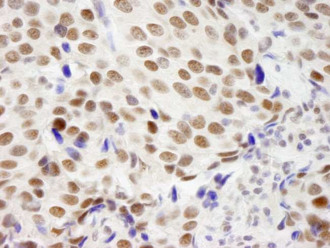 ZNF261 Antibody in Immunohistochemistry (IHC)