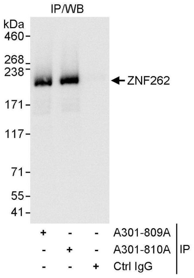 ZNF262 Antibody in Immunoprecipitation (IP)