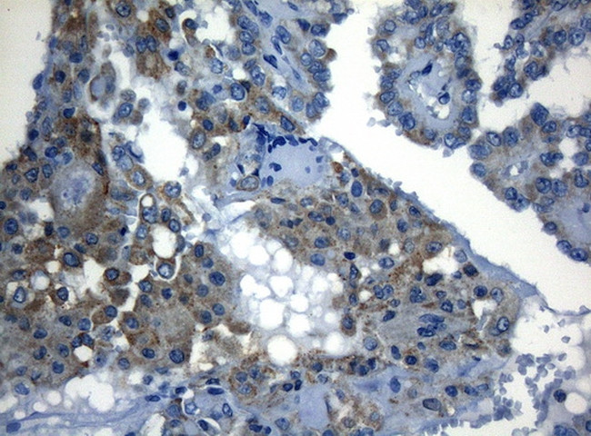 ZNF394 Antibody in Immunohistochemistry (Paraffin) (IHC (P))