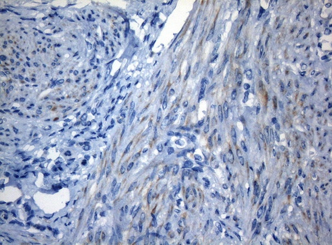 ZNF394 Antibody in Immunohistochemistry (Paraffin) (IHC (P))