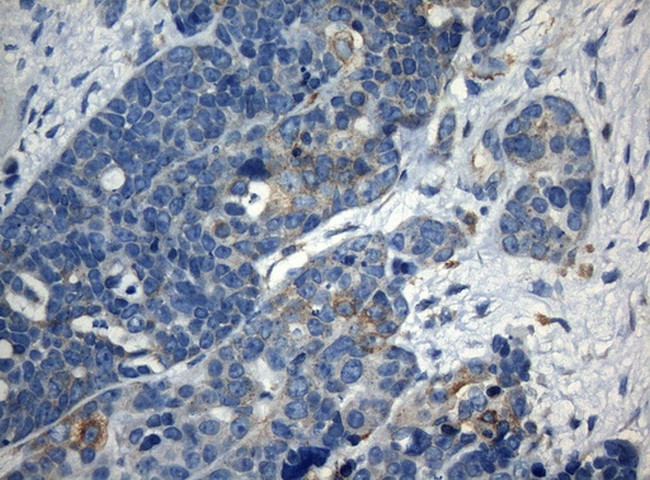 ZNF394 Antibody in Immunohistochemistry (Paraffin) (IHC (P))