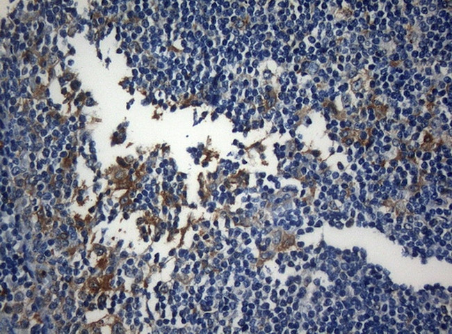 ZNF394 Antibody in Immunohistochemistry (Paraffin) (IHC (P))