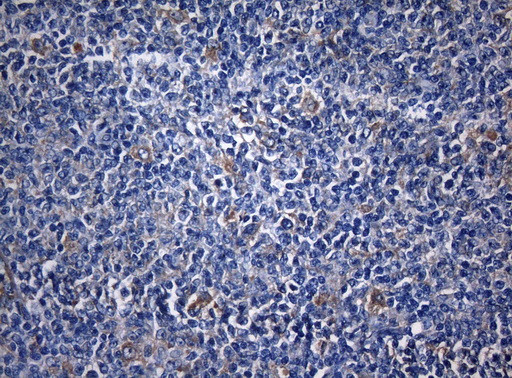 ZNF394 Antibody in Immunohistochemistry (Paraffin) (IHC (P))