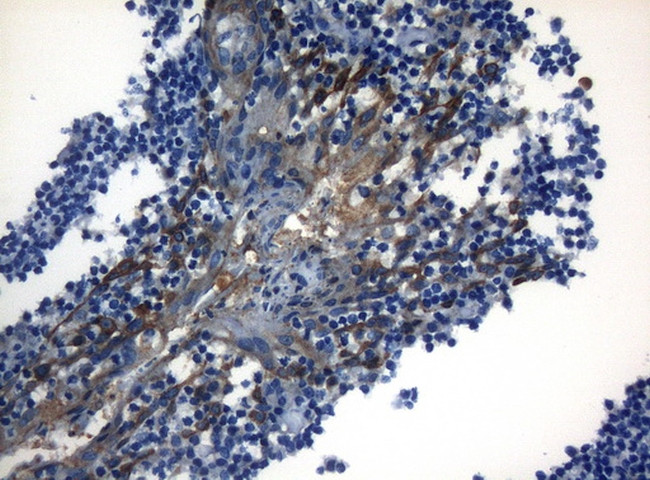 ZNF394 Antibody in Immunohistochemistry (Paraffin) (IHC (P))