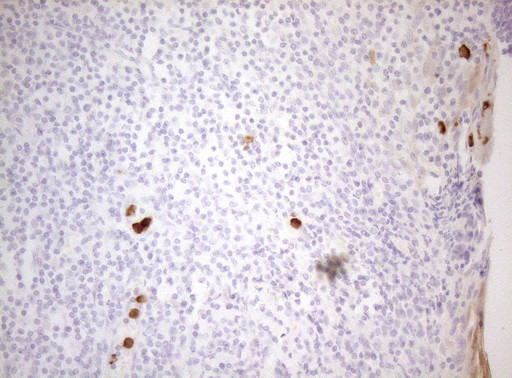 ZNF394 Antibody in Immunohistochemistry (Paraffin) (IHC (P))