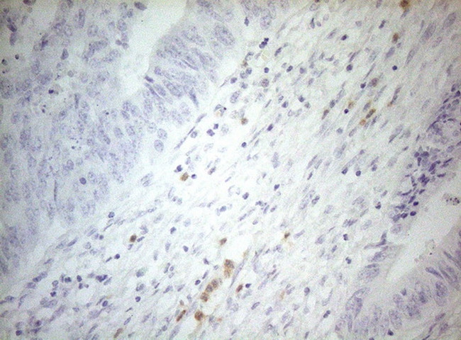 ZNF394 Antibody in Immunohistochemistry (Paraffin) (IHC (P))