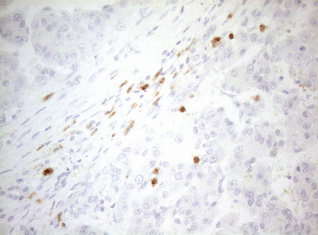 ZNF394 Antibody in Immunohistochemistry (Paraffin) (IHC (P))