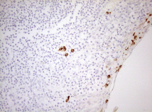 ZNF394 Antibody in Immunohistochemistry (Paraffin) (IHC (P))