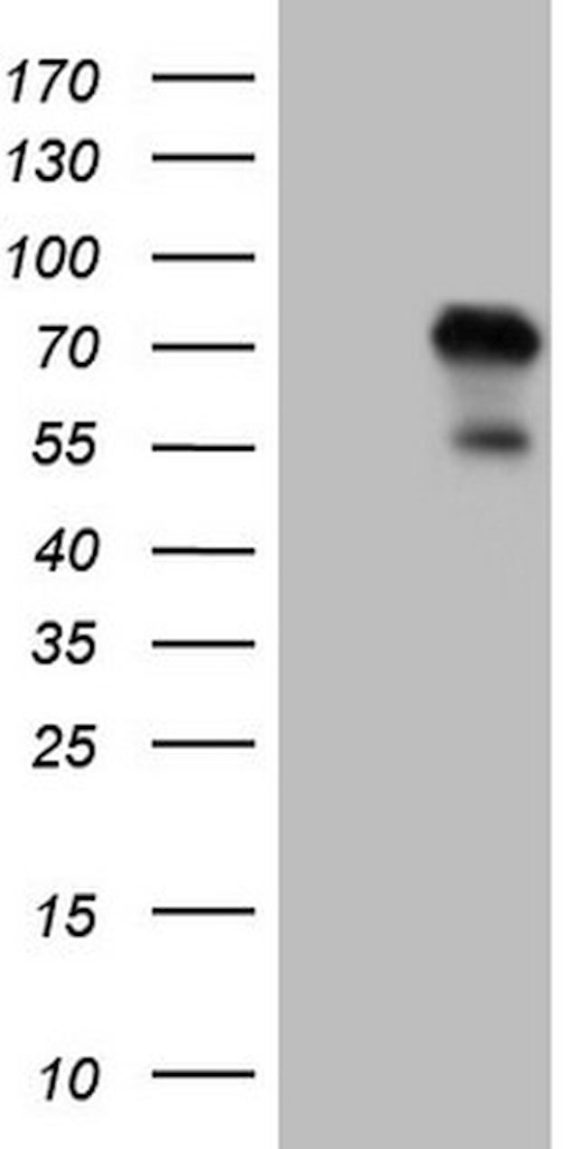 ZNF394 Antibody in Western Blot (WB)