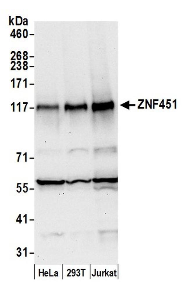 ZNF451 Antibody in Western Blot (WB)