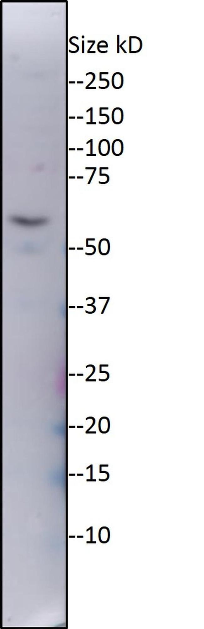 ZNF578 Antibody in Western Blot (WB)