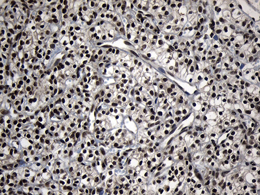 ZNF583 Antibody in Immunohistochemistry (Paraffin) (IHC (P))