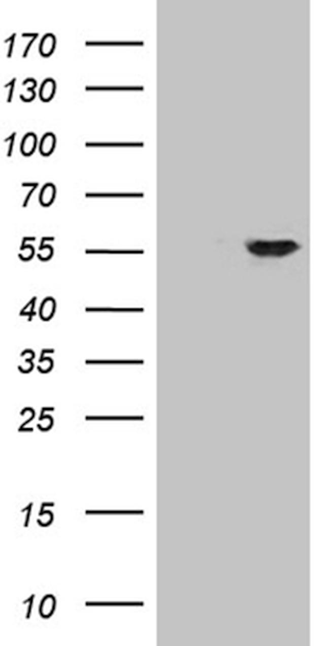 ZNF610 Antibody in Western Blot (WB)