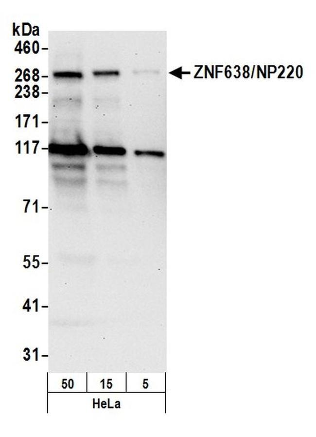 ZNF638/NP220 Antibody in Western Blot (WB)