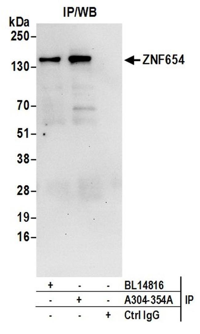 ZNF654 Antibody in Western Blot (WB)