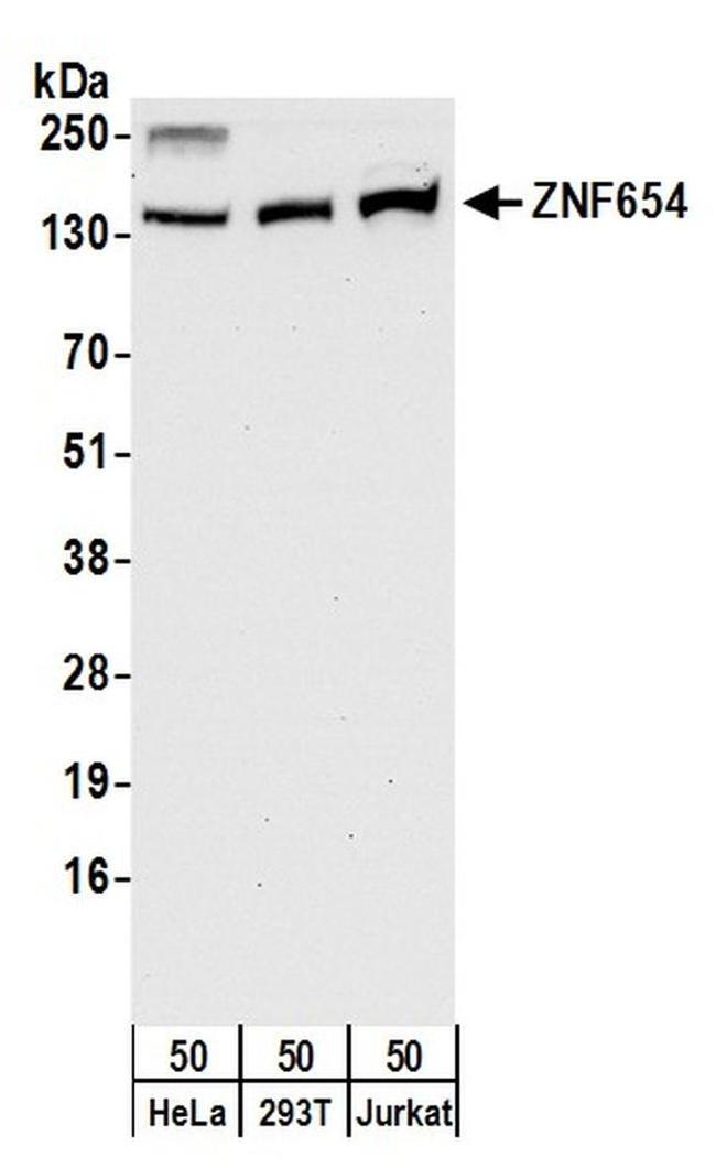 ZNF654 Antibody in Western Blot (WB)