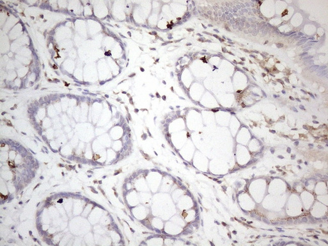 ZNF69 Antibody in Immunohistochemistry (Paraffin) (IHC (P))