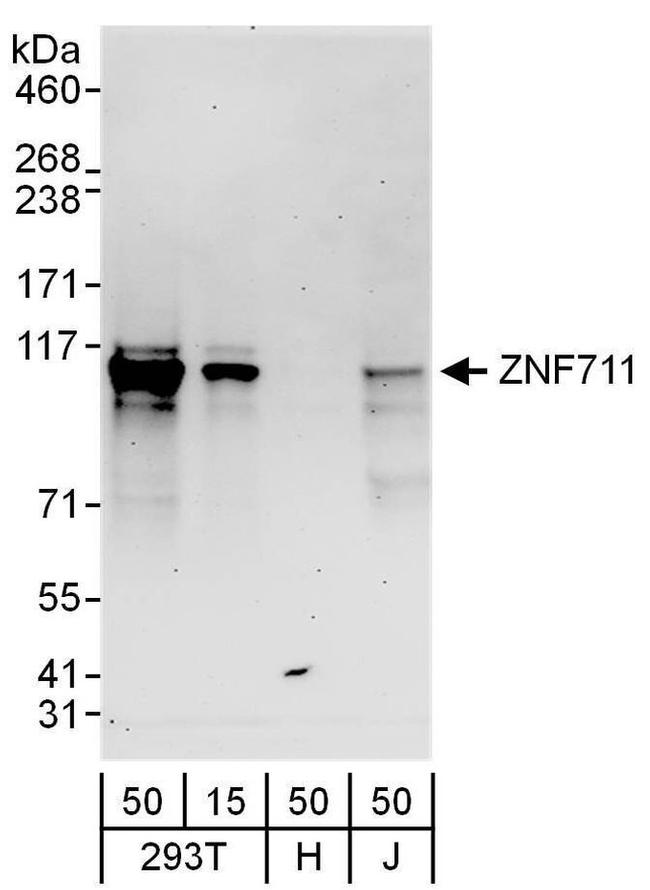 ZNF711 Antibody in Western Blot (WB)