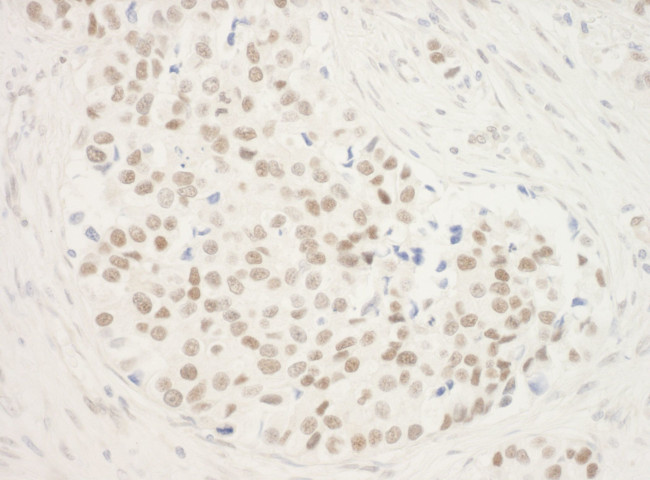 ZNF768 Antibody in Immunohistochemistry (IHC)