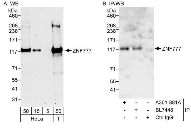 ZNF777 Antibody in Western Blot (WB)