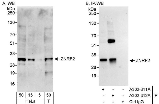 ZNRF2 Antibody in Western Blot (WB)