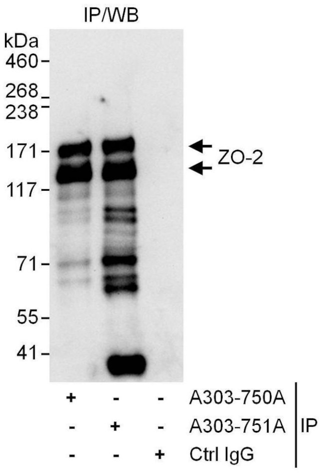 ZO-2 Antibody in Immunoprecipitation (IP)