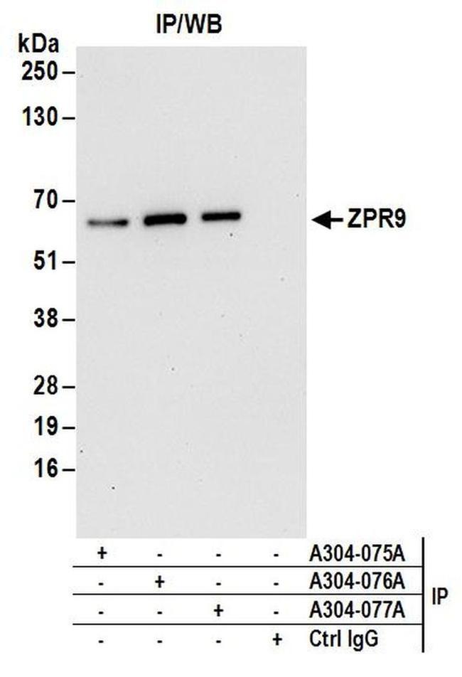 ZPR9 Antibody in Western Blot (WB)