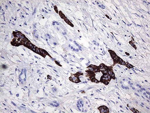 ZRANB1 Antibody in Immunohistochemistry (Paraffin) (IHC (P))