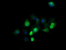 ZSCAN21 Antibody in Immunocytochemistry (ICC/IF)