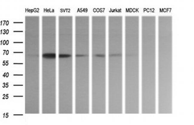 ZSCAN21 Antibody in Western Blot (WB)