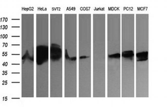 ZSCAN21 Antibody in Western Blot (WB)