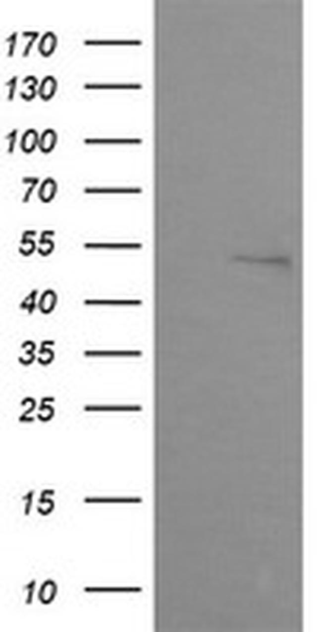 ZSCAN21 Antibody in Western Blot (WB)