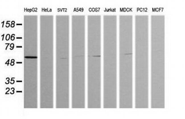 ZSCAN21 Antibody in Western Blot (WB)