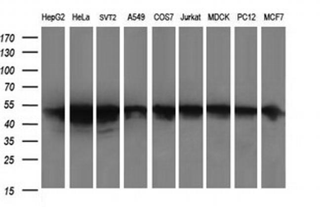 ZSCAN21 Antibody in Western Blot (WB)